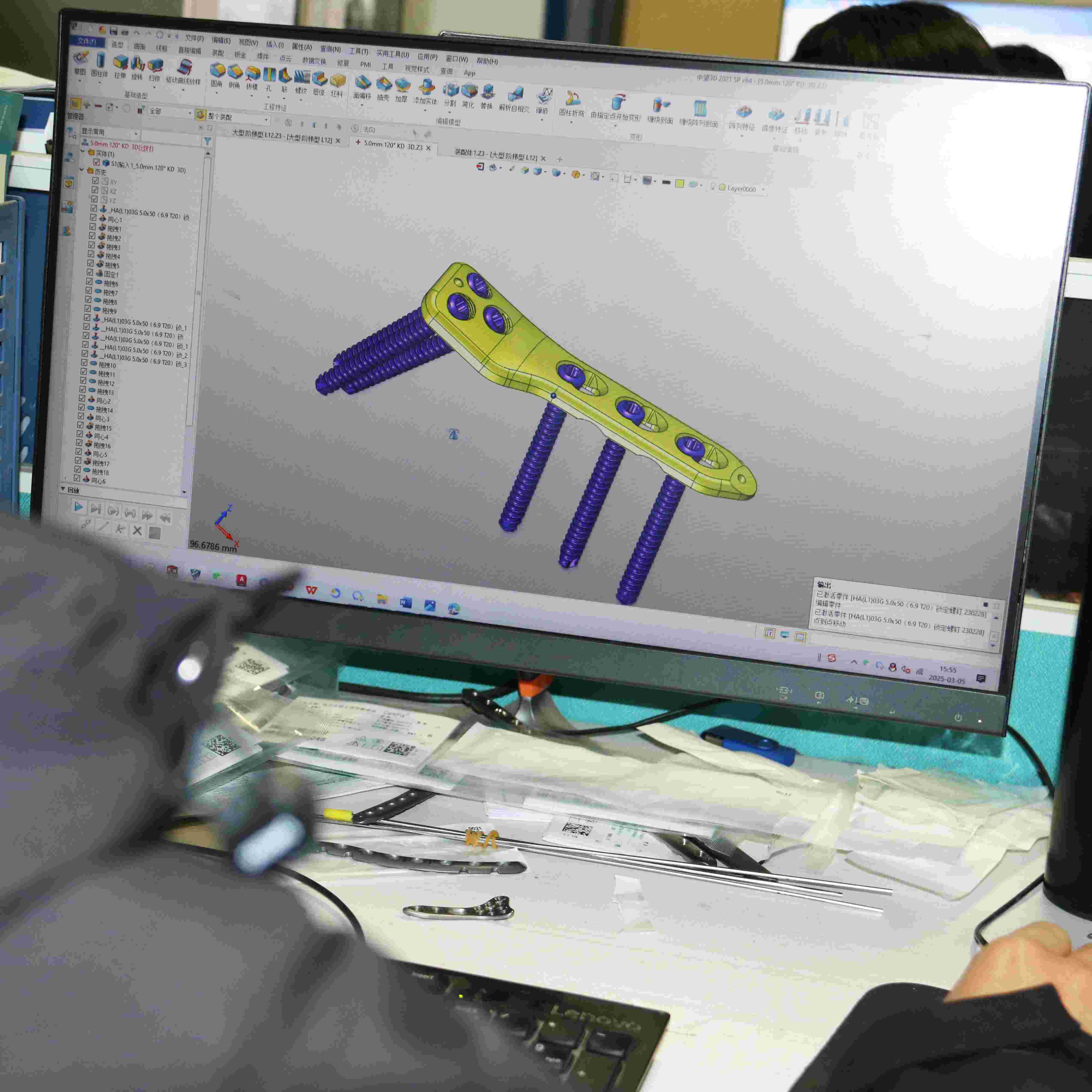 Anodizing and Surface Treatment for Bone Implants